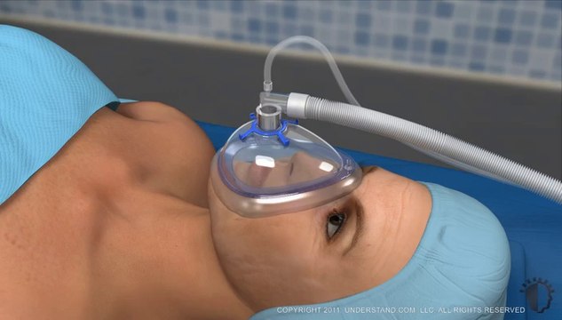 Facelift – Lower face -Alt Yüz Germe