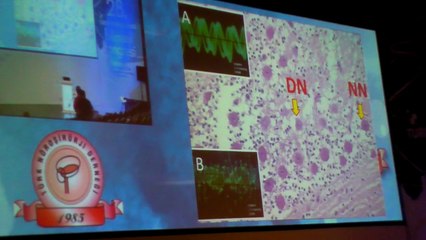 2014 Türk Nöroşirürji Derneği 28 Kongresi Prof Dr Mehmet Dumlu Aydin Ses Dalgaları