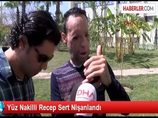 Yüz Nakilli Recep Sert: Esma Dürüstlüğümü Sevdi