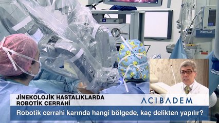 Robotik cerrahi karında hangi bölgede kaç delikten yapılır ?