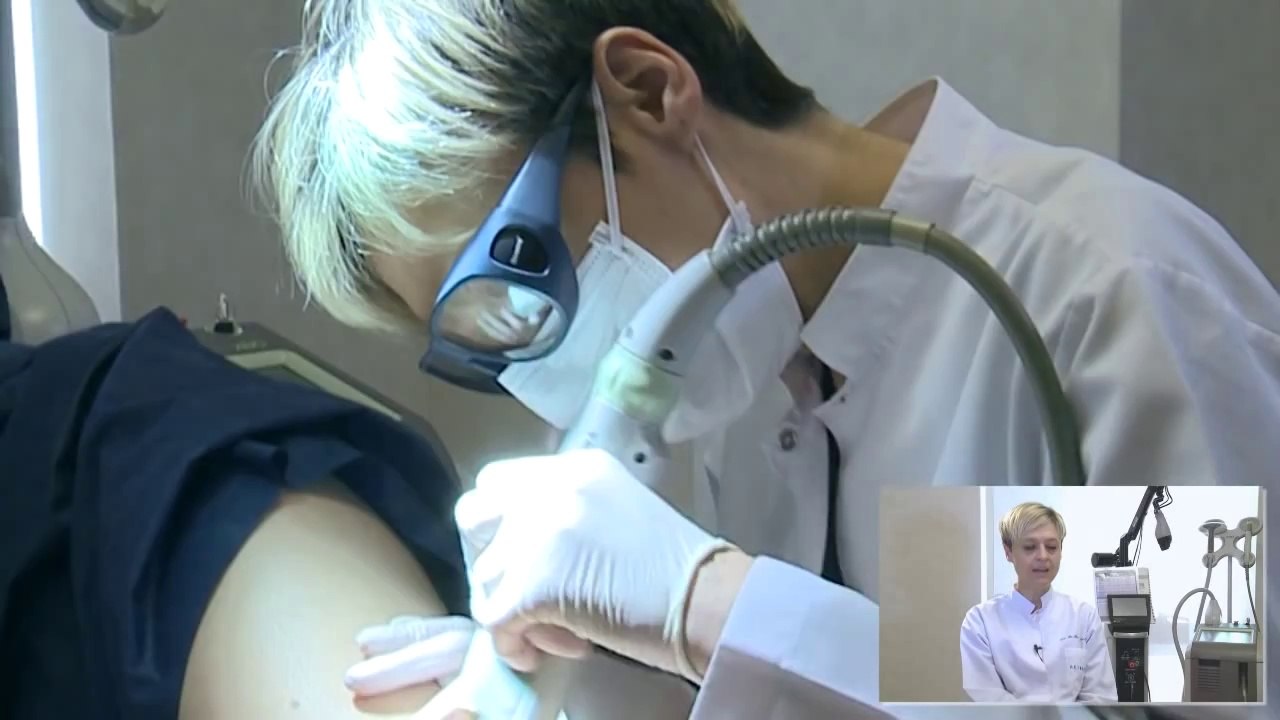 Kılcal damar ve varis için lazer uygulamasının yan etkileri var mıdır ?