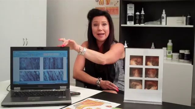 Hair Loss Treatments By Absolique Hair Health Clinic