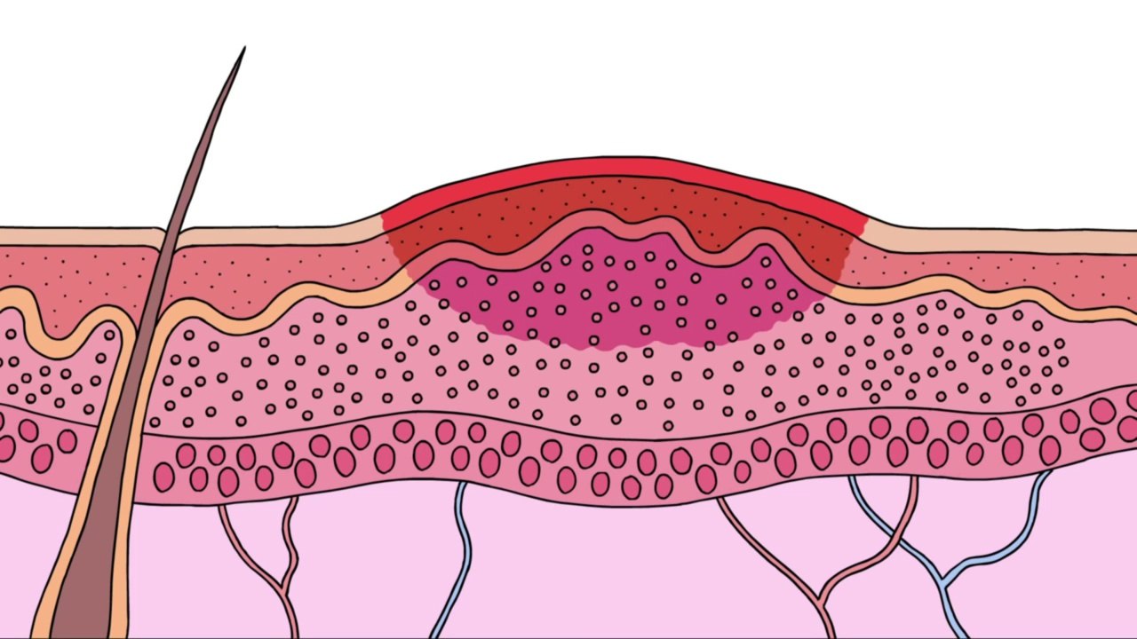 How do pain relievers work