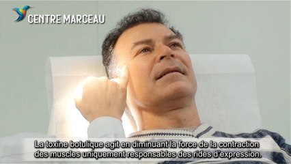 Traitement des rides d'expression par la toxine botulique