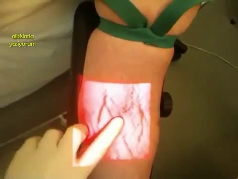 Acemi Hemşireler İçin Damar Bulma Cihazı