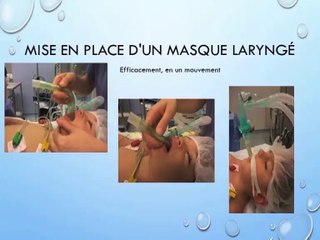 Paediatric anaesthesia : Tips and Tricks