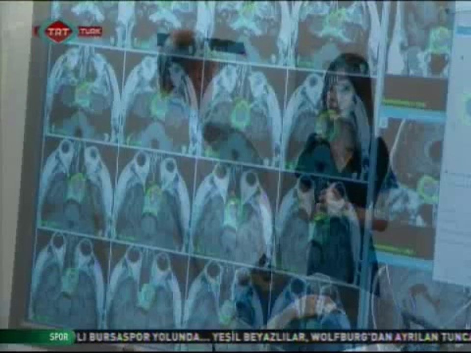 Beyin Cerrahisi - Beyin ve Sinir Cerrahisi Uzmanı Prof. Dr. Selçuk Paker anlatıyor.