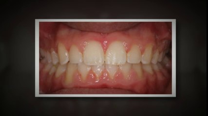 Dallas Orthodontist Apr2014