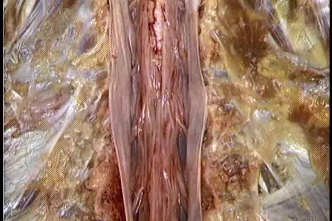 Human Anatomy Thorax part 1