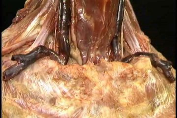 Human Anatomy Thorax part 2