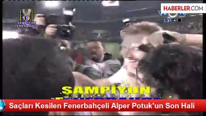 Saçları Kesilen Fenerbahçeli Alper Potuk'un Son Hali