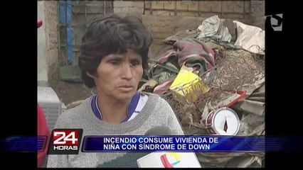SJL: Incendio deja sin hogar a niña con síndrome de Down
