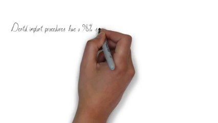 Facts about Dental Implants