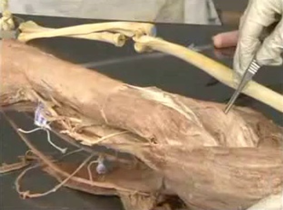 Human Anatomy Arm
