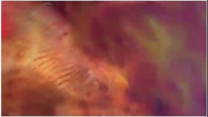 Melanie C talks about Spice Girls dance