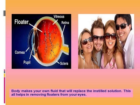 Causes And Symptoms Of Eye-floaters