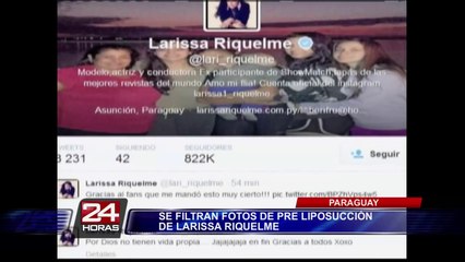Filtran fotos de Larissa Riquelme antes de cirugía estética
