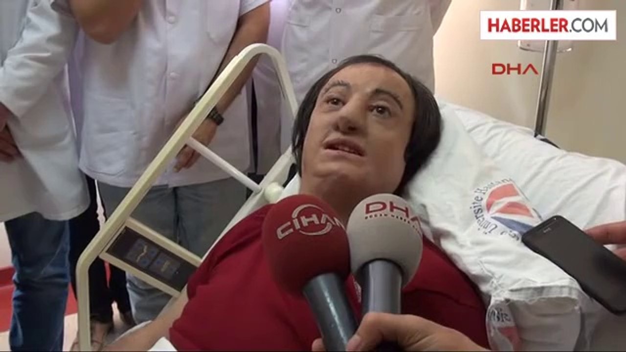 Gaziantep Pof. Dr. Mutaf'tan İkinci Nakilsiz Yüz Ameliyatı