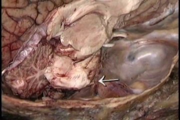 Human Anatomy Head and Neck Part 4