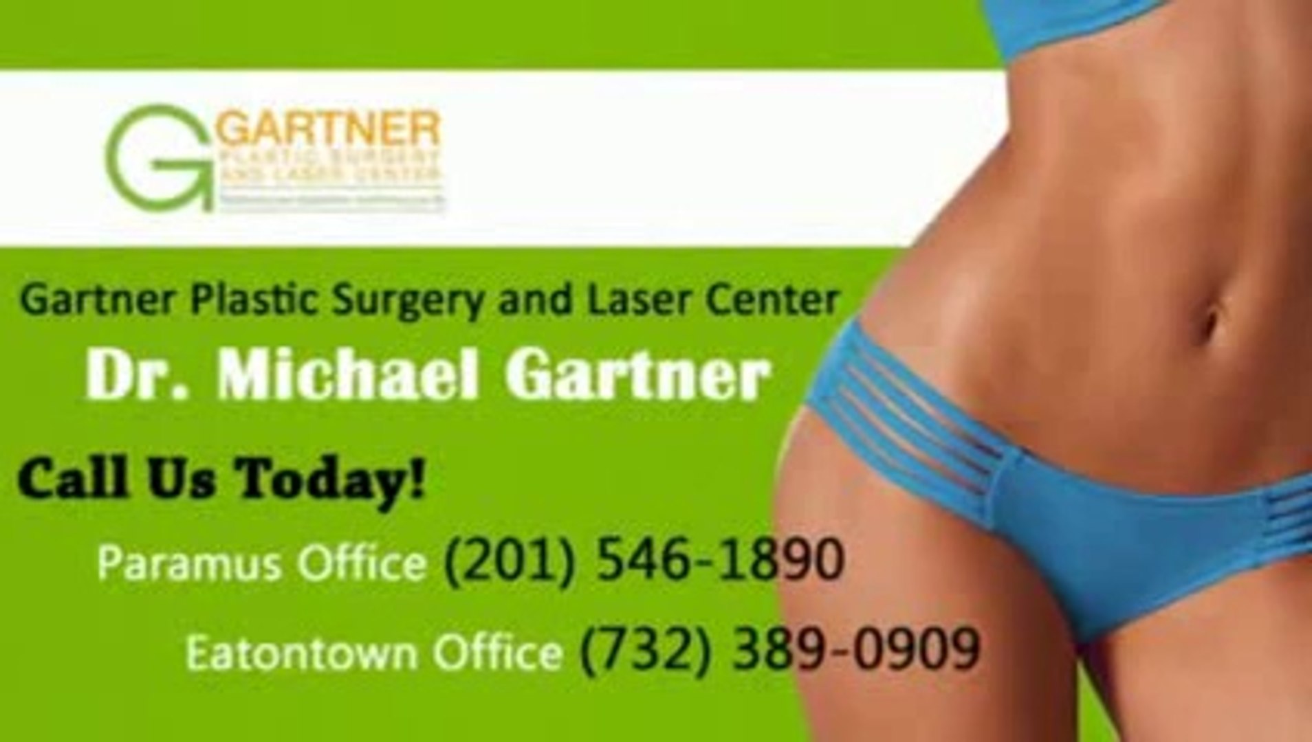 Liposuction Reviews New Jersey - Dr. Michael Gartner