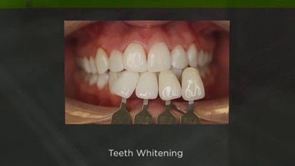 Holborn Dentist In London - Dr Monik Vasant