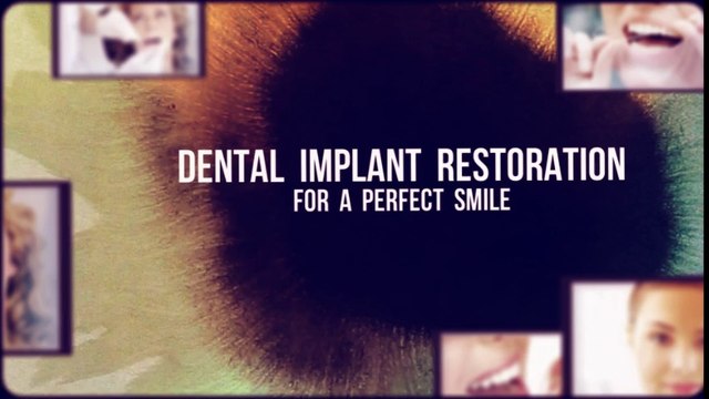 dental implants jupiter