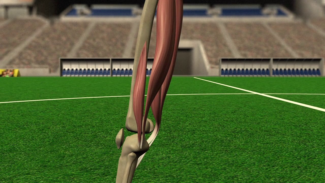 Les blessures des joueurs : les ischio-jambiers