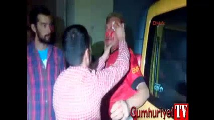 Polisten kaçarken yüzü kanlar içinde kaldı