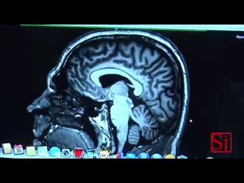 Napoli - Il vademecum per le donne in gravidanza con sclerosi multipla (31.05.14)