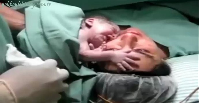 Yeni Doğmuş Bebeğin Annesinden Ayrılmak İstememesi