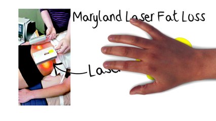 REDUCE Fat and Stretch Marks, ELIMINATE Cellulite and Lose Inches Today!