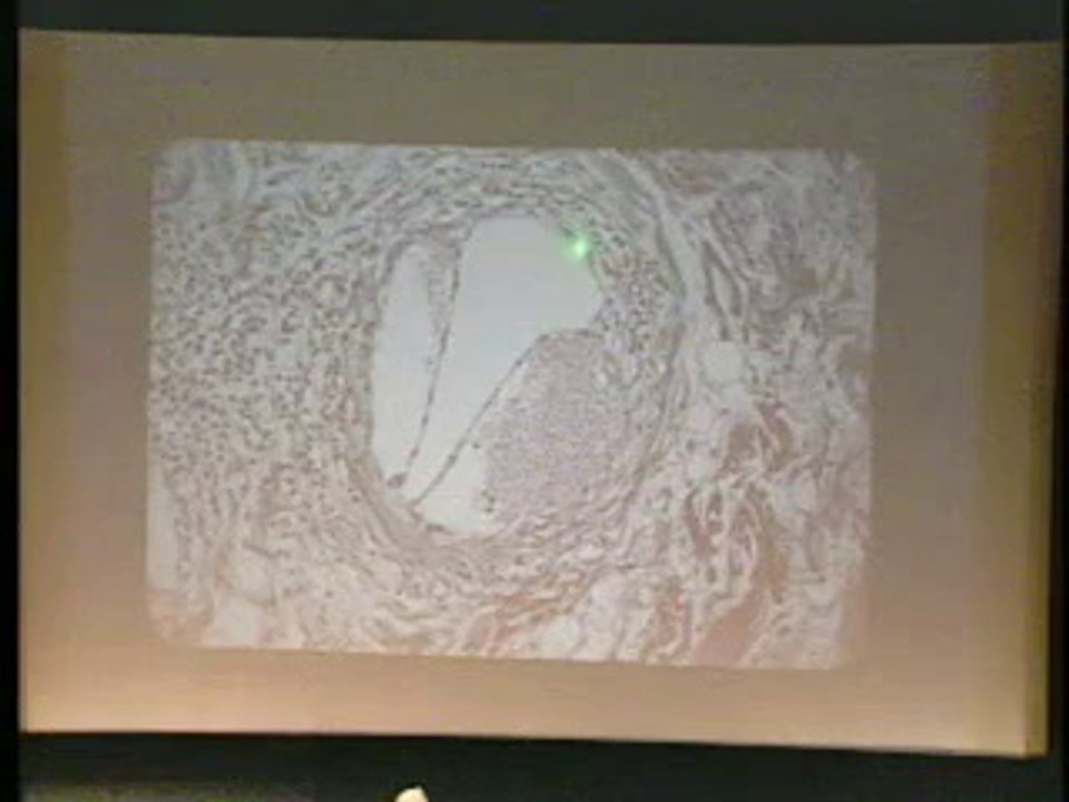 Lecture 09 - Liver II