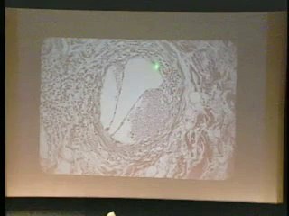 Lecture 09 - Liver II