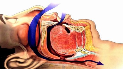 Dental Products - How Dentists Help Sleep Apnea Patients