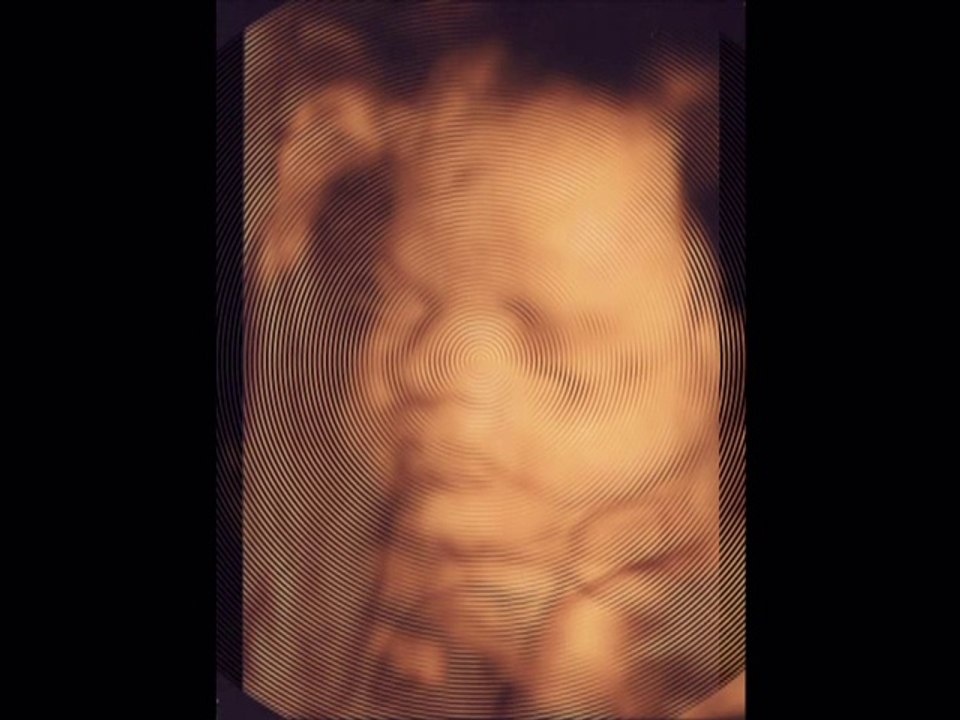 4 Boyutlu Ultrason ile Anne Karnında Bebek Resimleri