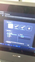 máy siêu âm màu 2d, siêu âm màu 4d 4 chiều ECUBE 9 0905479192