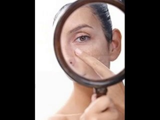 Skin Benefits of Turmeric