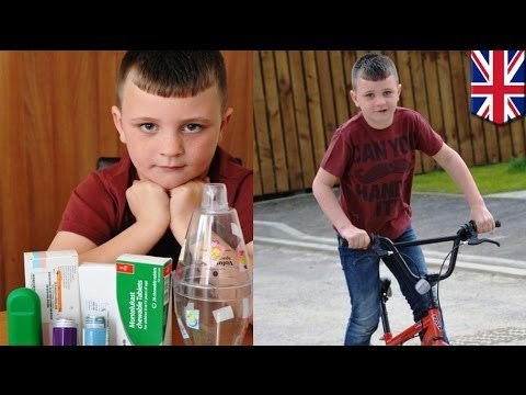 Extreme allergies: Boy allergic to own hair gets asthma attacks from strong emotions