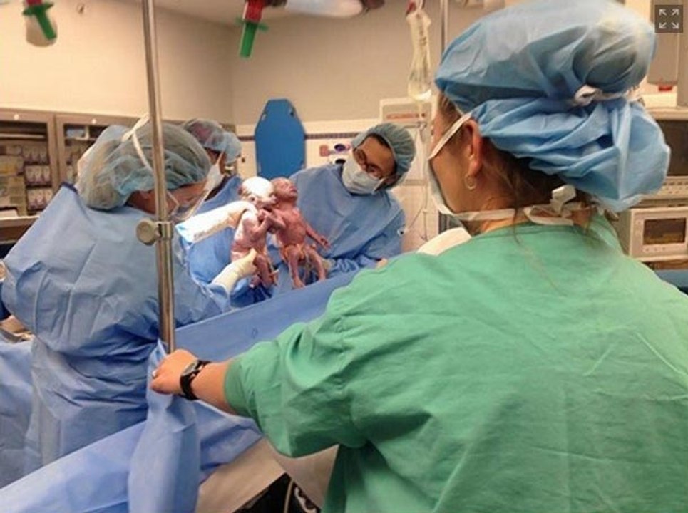 Jumelles s’attrapent la main après leur naissance
