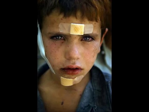 Alper | Savaş Çocuğu