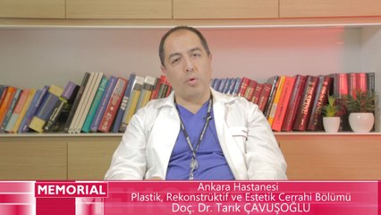 Karın Germe Operasyonu Kimlere Uygulanır?