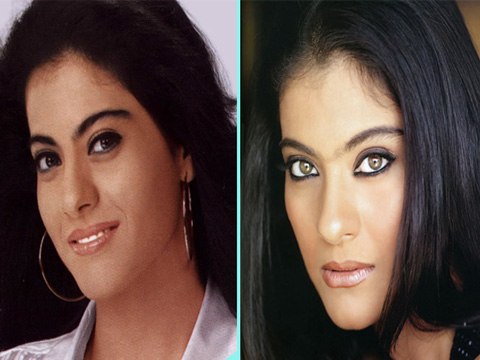 Kajol Undergoes Cosmetic Surgery