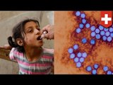 Polio outbreak: World Health Organization declares international public health emergency