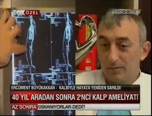 Ercüment Büyükakan 40 Yıl Sonra ikinci Kalp Ameliyatını oldu- Dr. Cem Alhan
