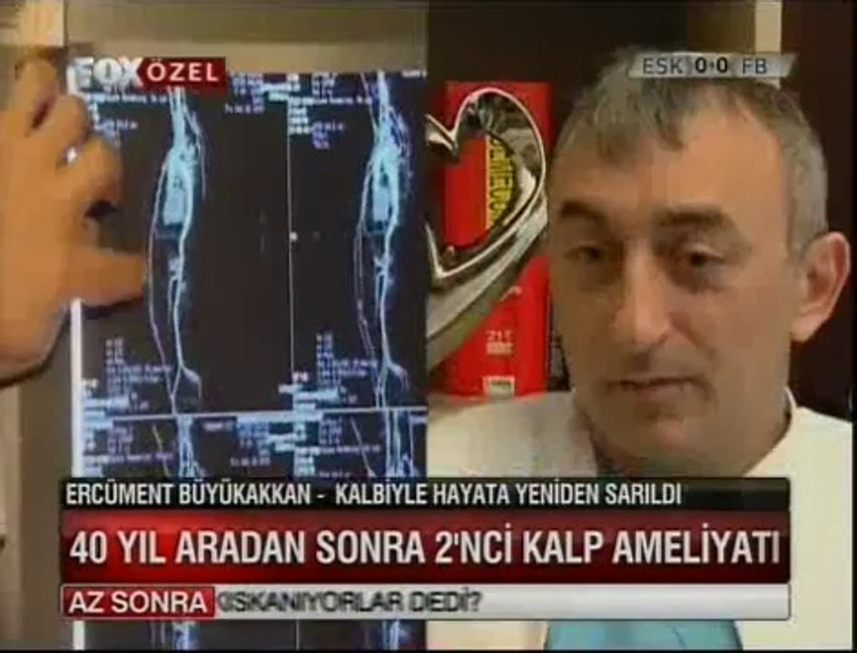 Ercüment Büyükakan 40 Yıl Sonra ikinci Kalp Ameliyatını oldu- Dr. Cem Alhan