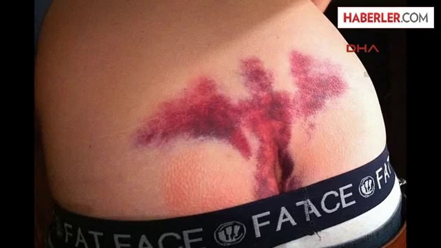 Dha Dış Haber ? Poposundaki Morluk ile Sosyal Medyanın Diline Düşdü