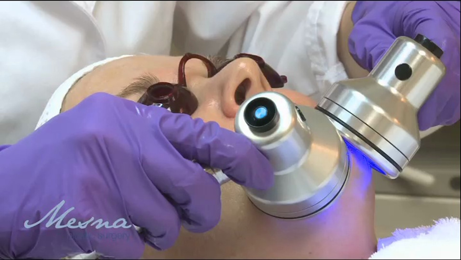 HydraFacial - Minneapolis - Mesna Plastic Surgery