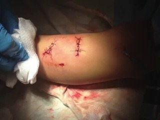 Η γάτα σώζει το παιδάκι από το σκύλο