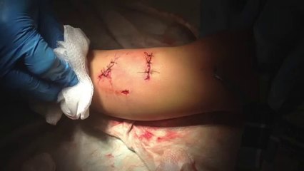 Mon chat a sauvé mon fils d'une terrible attaque de chien