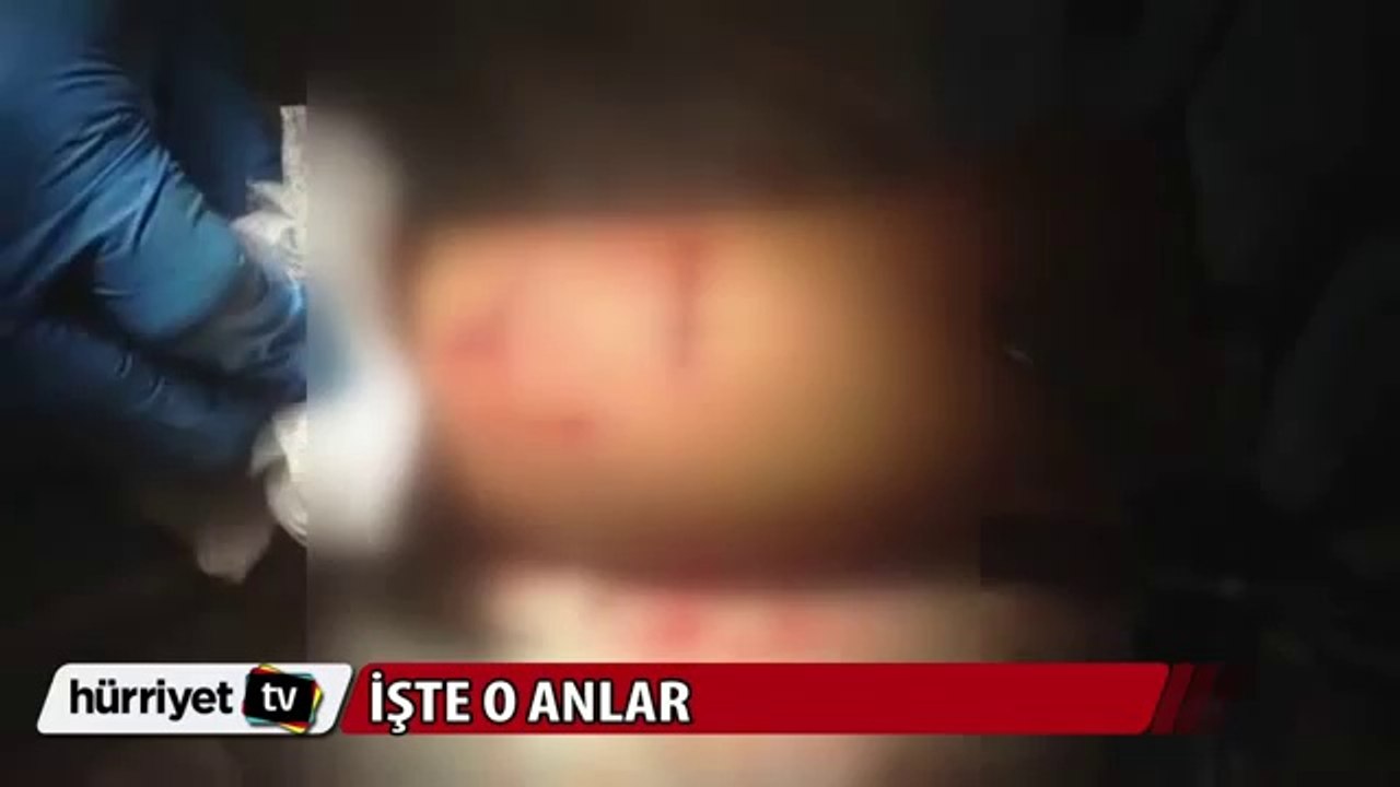 ABD'de köpeğin saldırdığı çocuğu kedi kurtardı